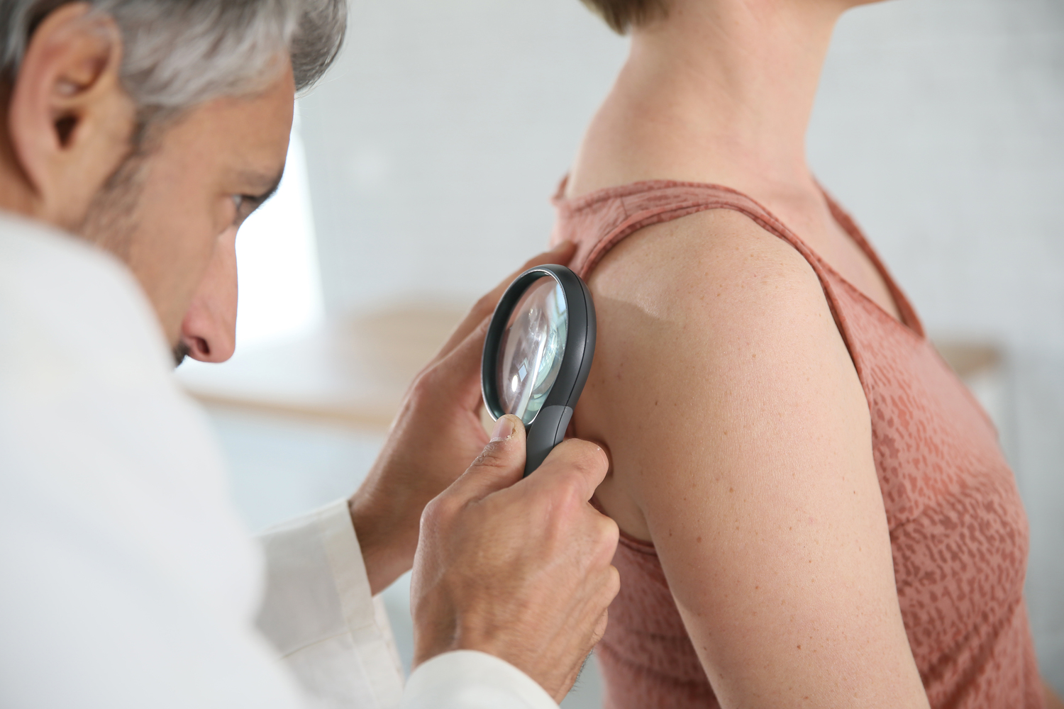 Melanoma: Prevention, Symptoms, and Treatment