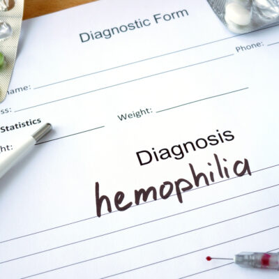 Everything to Know About Hemophilia