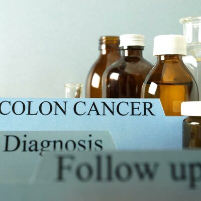 Stages of Colon Cancer and Their Treatment Methods