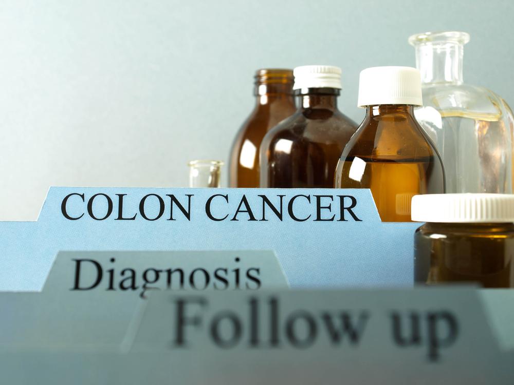 Stages of Colon Cancer and Their Treatment Methods