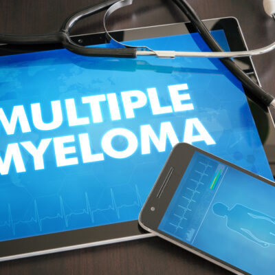 The Different Stages of Multiple Myeloma