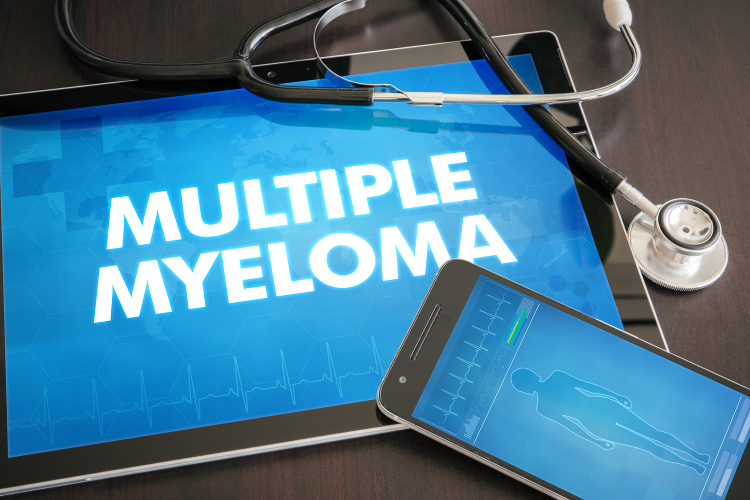 The Different Stages of Multiple Myeloma